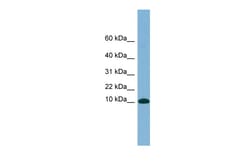 Aviva Systems Biology Corp B2M Antibody - N-terminal region (ARP56555_P050)