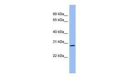 Aviva Systems Biology Corp PENK Antibody - middle region (ARP56676_P050)