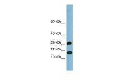 Aviva Systems Biology Corp TRAPPC2L Antibody - N-terminal region (ARP56852_P050)