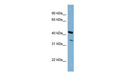Aviva Systems Biology Corp PEX26 Antibody - N-terminal region (ARP57067_P050)