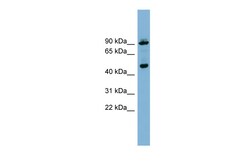 Aviva Systems Biology Corp WIPI1 Antibody - middle region (ARP57076_P050)