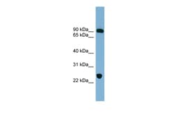 Aviva Systems Biology Corp VPS53 Antibody - middle region (ARP57192_P050)