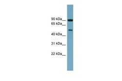 Aviva Systems Biology Corp PI4K2B Antibody - middle region (ARP57204_P050)