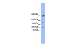 Aviva Systems Biology Corp LYRM1 Antibody - middle region (ARP57413_P050)