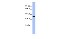 Aviva Systems Biology Corp PPM1A Antibody - middle region (ARP57765_P050)