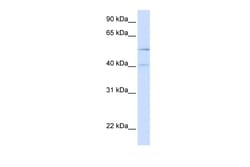 Aviva Systems Biology Corp ATG4B Antibody - N-terminal region (ARP57862_P050)