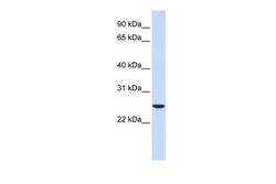 Aviva Systems Biology Corp UBE2K Antibody - middle region (ARP58012_P050)