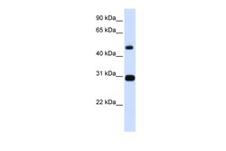 Aviva Systems Biology Corp PSMC3 Antibody - N-terminal region (ARP58175_P050)