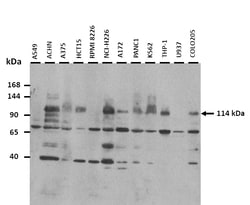 Aviva Systems Biology Corp SYCP1 Antibody - N-terminal region (ARP58330_P050)