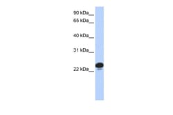 Aviva Systems Biology Corp CAPS Antibody - N-terminal region (ARP58435_P050)