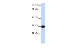 Aviva Systems Biology Corp PPP4C Antibody - middle region (ARP58516_P050)