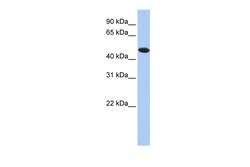 Aviva Systems Biology Corp TXNDC5 Antibody - N-terminal region (ARP58547_P050)