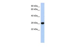 Aviva Systems Biology Corp FN3KRP Antibody - N-terminal region (ARP58624_P050)