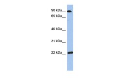 Aviva Systems Biology Corp TMED10 Antibody - middle region (ARP58728_P050)