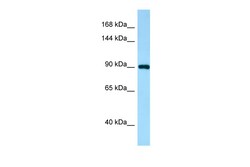 Aviva Systems Biology Corp JARID2 Antibody - N-terminal region (ARP58842_P050)