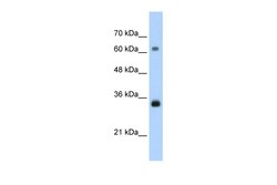 Aviva Systems Biology Corp PCNA Antibody - C-terminal region (AVARP03018_T100)