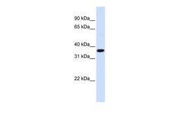Aviva Systems Biology Corp FOS Antibody - N-terminal region (AVARP04011_P050)