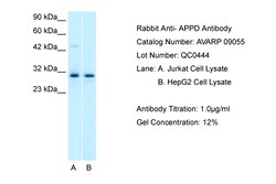 Aviva Systems Biology Corp APPD Antibody - C-terminal region (AVARP09055_T100)