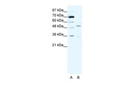 Aviva Systems Biology Corp CHRNG Antibody - N-terminal region (AVARP13024_T100)