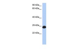 Aviva Systems Biology Corp RAB3A Antibody - C-terminal region (AVARP13056_T100)