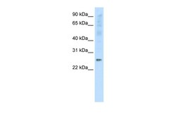 Aviva Systems Biology Corp SNAP25 Antibody - C-terminal region (AVARP13090_P050)