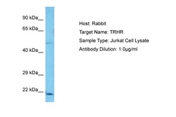 Aviva Systems Biology Corp TRHR Antibody - middle region (AVARP13104_T100)
