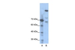 Aviva Systems Biology Corp GLI1 Antibody - N-terminal region (P100609_T100)