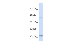 Aviva Systems Biology Corp NHLH1 Antibody - N-terminal region (P100926_P050)