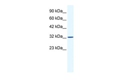 Aviva Systems Biology Corp SNAPC2 Antibody - middle region (P100961_T100)
