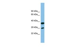 Aviva Systems Biology Corp RTP4 Antibody - middle region (ARP57612_P050)
