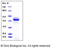Sino Biological Mouse Cathepsin L / CTSL Protein (His Tag) 50ug, Quantity: