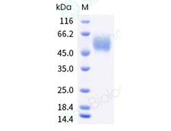 Sino Biological SARS-CoV-2 (2019-nCoV) Spike S1 (L18F, D80A, D215G, LAL242-244