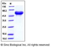 Sino Biological Mouse Arylsulfatase A / ARSA Protein (His Tag) 50ug, Quantity: