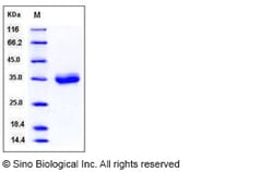 Sino Biological Recombinant Mouse CXADR/CAR Protein (His Tag) 1, Quantity: