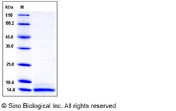Sino Biological Recombinant Mouse CCL6 Protein (His Tag), Quantity: Each