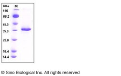 Sino Biological Recombinant Mouse SFRP2 Protein (His Tag), HPLC-verified,