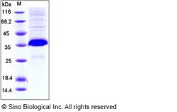 Sino Biological Mouse FLRG / Fstl3 Protein (His Tag) 50ug, Quantity: Each
