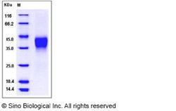 Sino Biological Recombinant Mouse CD32B/Fcgr2b Protein (His & AVI Tag),