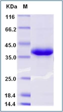 Sino Biological Recombinant Mouse SFRP1 Protein (His Tag), Quantity: Each