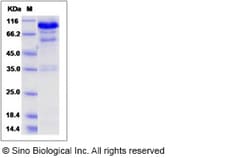 Sino Biological Recombinant Mouse HGF Protein (His Tag) 1, Quantity: Each