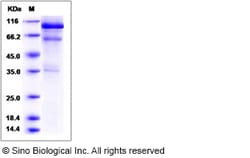 Sino Biological Recombinant Mouse HGF Protein 1, Quantity: Each of 1
