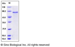Sino Biological Mouse ADAM9 Protein (His Tag) 500ug, Quantity: Each of