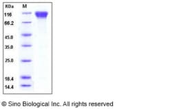 Sino Biological Mouse CD62L / L-Selectin / SELL Protein (His & Fc Tag)