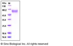 Sino Biological Recombinant Mouse SFRP4 Protein (His Tag), Quantity: Each