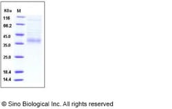 Sino Biological Recombinant Mouse IL-34 Protein (His Tag), Quantity: Each