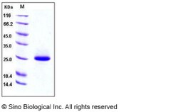 Sino Biological Recombinant Mouse Lipocalin-2/NGAL Protein (His Tag), HPLC-verified,