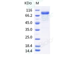 Sino Biological Recombinant Mouse IL-13 R alpha 2/IL13RA2 Protein (ECD,