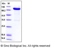 Sino Biological Recombinant Mouse IL-13 R alpha 2/IL13RA2 Protein (His