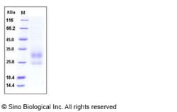 Sino Biological Mouse LY86 / MD-1 Protein (His Tag) 100ug, Quantity: Each