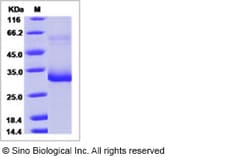 Sino Biological Recombinant Mouse Mannan Binding Lectin/MBL2 Protein (His